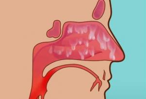 Hiperosmija: deprivacija čula mirisa