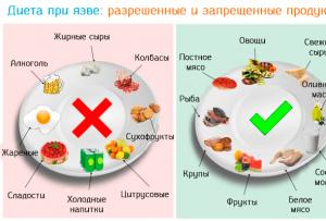 Dietní potravina pro skvamózní infekci Dieta pro scutulózní infekci: co je možné